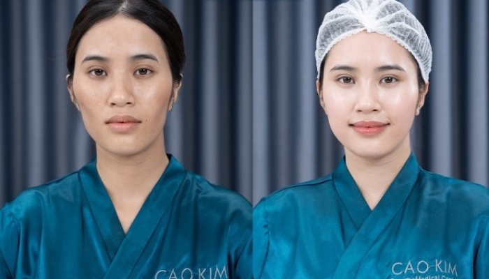 Sự hiệu quả sau khi sử dụng dịch vụ thẩm mỹ của khách hàng tại Cao Kim